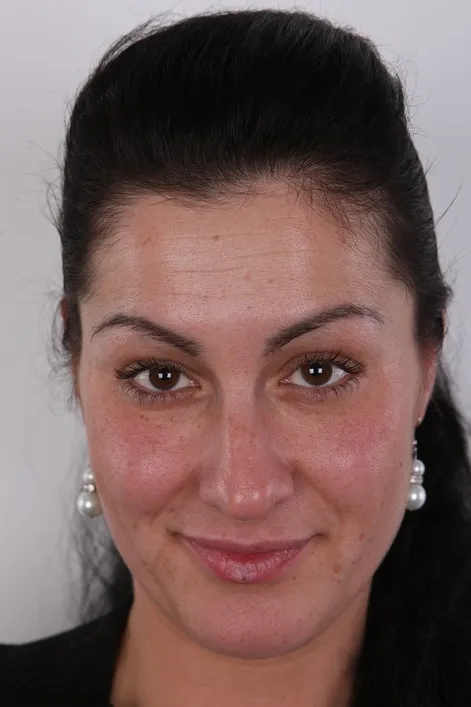 Andrea