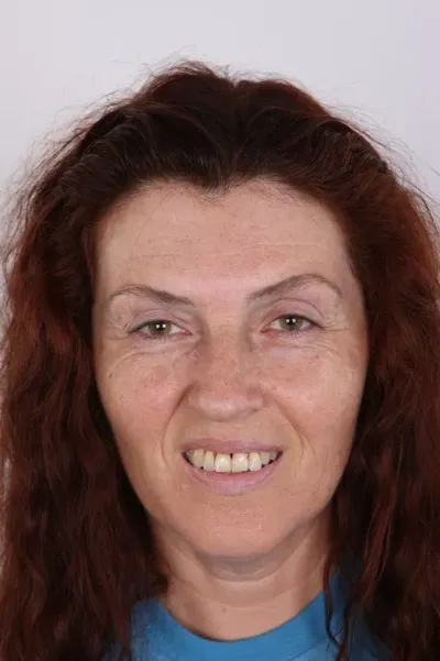 Ivana